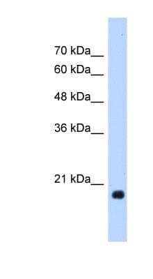 Western Blot: HSP20/HSPB6 Antibody [NBP1-55523] - HepG2 cell lysate, concentration 1.25ug/ml.