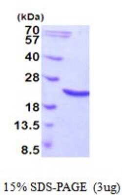 SDS-Page: Recombinant Human HSP20/HSPB6 Protein [NBP2-52013] -  15% SDS Page (3 ug)