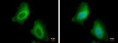 Immunocytochemistry/Immunofluorescence: HSP27 Antibody [NBP2-16891] - HSP27 antibody detects HSP27 protein at cytoplasm by immunofluorescent analysis. Sample: HeLa cells were fixed in 4% paraformaldehyde at RT for 15 min. Green: HSP27 protein stained by HSP27 antibody diluted at 1:500. Blue: Hoechst 33342 staining.
