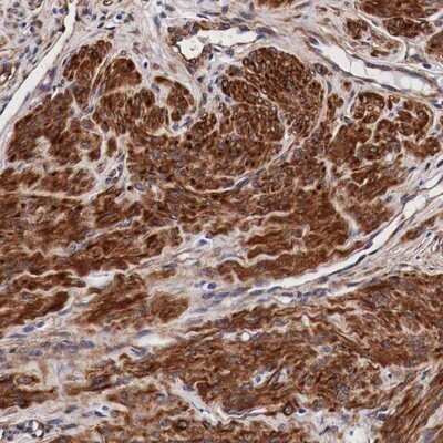 Immunohistochemistry-Paraffin: HSP27 Antibody [NBP1-89666] - Immunohistochemical staining of human smooth muscle shows strong cytoplasmic positivity in smooth muscle cells.