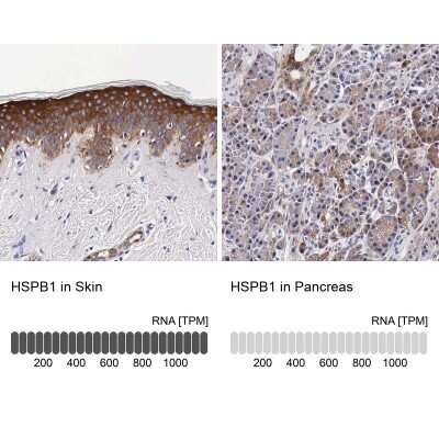 <b>Orthogonal Strategies Validation. </b>Immunohistochemistry-Paraffin: HSP27 Antibody [NBP1-89666] - Staining in human skin and pancreas tissues using anti-HSPB1 antibody. Corresponding HSPB1 RNA-seq data are presented for the same tissues.