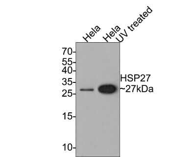 Western Blot: HSP27 [p Ser78] Antibody (JJ08-70) [NBP2-67844] - Analysis of HSP27 [p Ser78] on different lysates with Rabbit anti-HSP27 [p Ser78] antibody at 1/500 dilution. Lane 1: Hela cell lysate Lane 2: Hela cell lysate treated with UV for 2 hours Lysates/proteins at 10 ug/Lane. Predicted band size: 23 kDa Observed band size: 27 kDa Exposure time: 2 minutes; 15% SDS-PAGE gel. Proteins were transferred to a PVDF membrane and blocked with 5% NFDM/TBST for 1 hour at room temperature. The primary antibody at 1/500 dilution was used in 5% NFDM/TBST at room temperature for 2 hours. Goat Anti-Rabbit IgG - HRP Secondary Antibody at 1:300,000 dilution was used for 1 hour at room temperature.