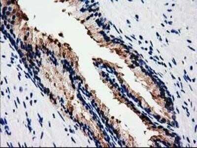 Immunohistochemistry: HSP40/DNAJB1 Antibody (OTI1F9) - Azide and BSA Free [NBP2-70969] - Hsp40/DNAJB1 Antibody (1F9) Staining of paraffin-embedded Human prostate tissue using anti-Hsp40 mouse monoclonal antibody.