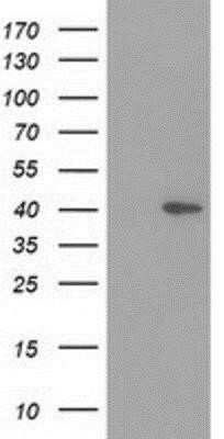 Western Blot: HSP40/DNAJB1 Antibody (OTI1F9) - Azide and BSA Free [NBP2-70969] - Hsp40/DNAJB1 Antibody (1F9) HEK293T cells were transfected with the pCMV6-ENTRY control (Left lane) or pCMV6-ENTRY Hsp40 (Right lane) cDNA for 48 hrs and lysed. Equivalent amounts of cell lysates (5 ug per lane) were separated by SDS-PAGE and immunoblotte