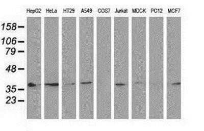 Western Blot: HSP40/DNAJB1 Antibody (OTI1F9) - Azide and BSA Free [NBP2-70969] - Hsp40/DNAJB1 Antibody (1F9) Analysis of extracts (35ug) from 9 different cell lines by using anti-Hsp40 monoclonal antibody (HepG2: human; HeLa: human; SVT2: mouse; A549: human; COS7: monkey; Jurkat: human; MDCK: canine; PC12: rat; MCF7: human).