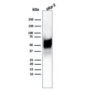 Western Blot: HSP60 Antibody (HSPD1/6496R) - Azide and BSA Free [NBP3-08938] - Western blot analysis of Hep2 cell lysate using HSP60 Rabbit Recombinant Monoclonal Antibody (HSPD1/6496R).