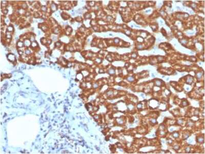 Immunohistochemistry-Paraffin: HSP60 Antibody (HSPD1/875) - Azide and BSA Free [NBP2-47844] - Formalin-fixed, paraffin-embedded human liver in colon stained with HSP60 Mouse Monoclonal Antibody (HSPD1/875).