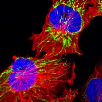 <b>Independent Antibodies Validation. </b>Immunocytochemistry/Immunofluorescence: HSP60 Antibody [NBP1-89730] - Staining of human cell line U-251 MG shows localization to mitochondria. Antibody staining is shown in green.