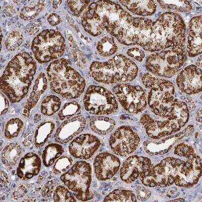 Immunohistochemistry-Paraffin: HSP60 Antibody [NBP1-89730] - Staining of human kidney shows strong cytoplasmic positivity in cells of renal tubules.