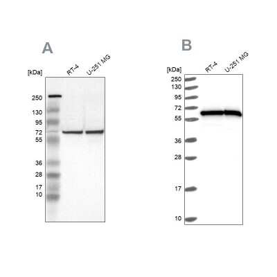 Western Blot: HSP60 Antibody [NBP1-89730] - Analysis using Anti-HSPD1 antibody NBP1-89730 (A) shows similar pattern to independent antibody NBP2-55503 (B).