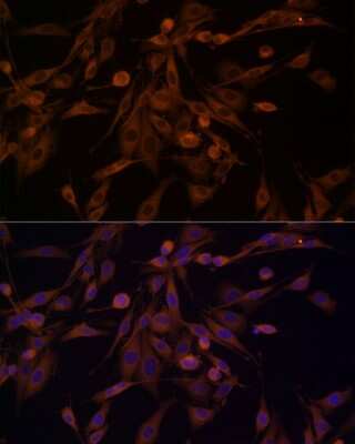 Immunocytochemistry/Immunofluorescence: HSP70/HSPA1A Antibody [NBP3-16090] - Immunofluorescence analysis of PC-12 cells using HSP70/HSPA1A Rabbit pAb (NBP3-16090) at dilution of 1:100 (40x lens). Blue: DAPI for nuclear staining.