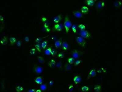 Immunocytochemistry/Immunofluorescence: HSP90 Antibody (4F8) [NBP3-15146] - Immunofluorescence staining of Hela cells with at HSP90 antibody 1:29, counter-stained with DAPI. The cells were fixed in 4% formaldehyde, permeabilized using 0.2% Triton X-100 and blocked in 10% normal Goat Serum. The cells were then incubated with the antibody overnight at 4C. The secondary antibody was Alexa Fluor 488-congugated Goat Anti-Rabbit IgG (H+L).