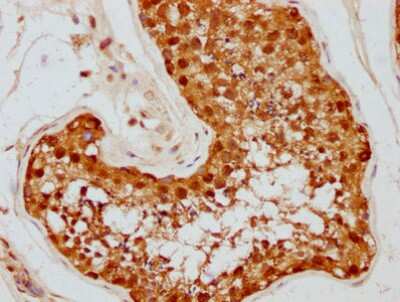 Immunohistochemistry: HSP90 Antibody (4F8) [NBP3-15146] - IHC image of HSP90 antibody diluted at 1:87.5 and staining in paraffin-embedded human testis tissue. After dewaxing and hydration, antigen retrieval was mediated by high pressure in a citrate buffer (pH 6.0). Section was blocked with 10% normal goat serum 30 minutes at RT. Then primary antibody (1% BSA) was incubated at 4C overnight. The primary is detected by a biotinylated secondary antibody and visualized using an HRP conjugated SP system.