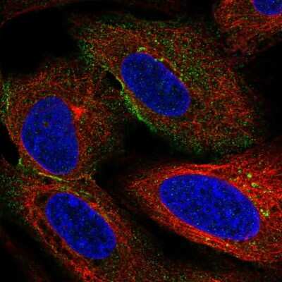 Immunocytochemistry/Immunofluorescence: HSPA12A Antibody [NBP2-57850] - Staining of human cell line U-2 OS shows localization to cytosol & the Golgi apparatus.