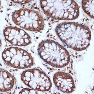 Immunohistochemistry-Paraffin: HSPA14 Antibody (4L1Z6) [NBP3-16107] - Immunohistochemistry of paraffin-embedded human colon using HSPA14 Rabbit mAb (NBP3-16107) at dilution of 1:100 (40x lens).Perform microwave antigen retrieval with 10 mM Tris/EDTA buffer pH 9.0 before commencing with IHC staining protocol.