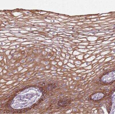 Immunohistochemistry-Paraffin: HSPA14 Antibody [NBP2-14106] - Staining of human vagina shows strong cytoplasmic and membranous positivity in squamous epithelial cells.