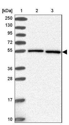 Western Blot: HSPA14 Antibody [NBP2-14106] - Lane 1: Marker  [kDa] 250, 130, 95, 72, 55, 36, 28, 17, 10.  Lane 2: Human cell line RT-4.  Lane 3: Human cell line U-251MG sp