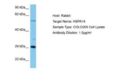 Western Blot: HSPA14 Antibody [NBP2-85081] - Host: Rabbit. Target Name: HSPA14. Sample Tissue: Human COLO205 Whole Cell lysates. Antibody Dilution: 1ug/ml