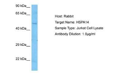 Western Blot: HSPA14 Antibody [NBP2-85082] - Host: Rabbit. Target Name: HSPA14. Sample Tissue: Human Jurkat Whole Cell lysates. Antibody Dilution: 1ug/ml