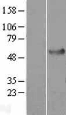 Western Blot: HSPA14 Overexpression Lysate (Adult Normal) [NBP2-07060] Left-Empty vector transfected control cell lysate (HEK293 cell lysate); Right -Over-expression Lysate for HSPA14.