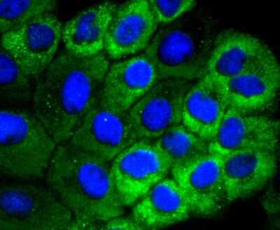 Immunocytochemistry/Immunofluorescence: HSPB8/HSP22 Antibody (JJ08-53) [NBP2-67836] - Staining Hsp22 in A431 cells (green). The nuclear counter stain is DAPI (blue). Cells were fixed in paraformaldehyde, permeabilised with 0.25% Triton X100/PBS.