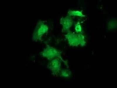 Immunocytochemistry/Immunofluorescence: HSPB8/HSP22 Antibody (OTI1E3) - Azide and BSA Free [NBP2-71828] - Staining of COS7 cells transiently transfected by pCMV6-ENTRY Hsp22.