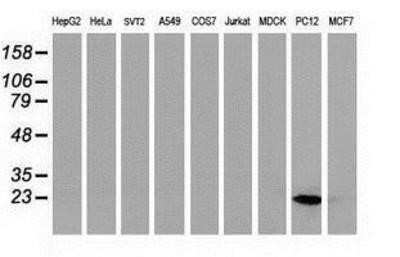 Western Blot: HSPB8/HSP22 Antibody (OTI1E3) - Azide and BSA Free [NBP2-71828] - Analysis of extracts (35ug) from 9 different cell lines by using anti-Hsp22 monoclonal antibody.