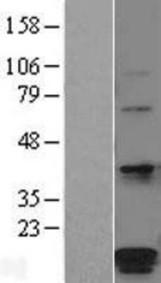 Western Blot: HSPC014 Overexpression Lysate (Adult Normal) [NBL1-14600] Left-Empty vector transfected control cell lysate (HEK293 cell lysate); Right -Over-expression Lysate for HSPC014.
