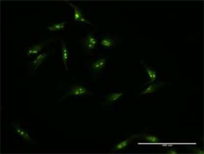 Immunocytochemistry/Immunofluorescence: HSPC111 Antibody [H00051491-D01P] - Analysis of antibody to NOP16 on HeLa cell. Antibody concentration 10 ug/ml.