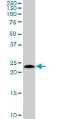 Western Blot: HSPC111 Antibody [H00051491-D01P] - Analysis of HSPC111 expression in mouse spleen.