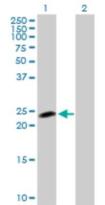 Western Blot: HSPC111 Antibody [H00051491-D01P] - Analysis of NOP16 expression in transfected 293T cell line by NOP16 polyclonal antibody.Lane 1: HSPC111 transfected lysate(21.20 KDa).Lane 2: Non-transfected lysate.