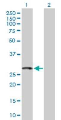 Western Blot: HSPC111 Antibody [H00051491-D03P] - Analysis of NOP16 expression in transfected 293T cell line by NOP16 polyclonal antibody.Lane 1: HSPC111 transfected lysate(26.60 KDa).Lane 2: Non-transfected lysate.