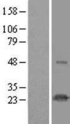 Western Blot: HSPC111 Overexpression Lysate (Adult Normal) [NBL1-11764] Left-Empty vector transfected control cell lysate (HEK293 cell lysate); Right -Over-expression Lysate for HSPC111.