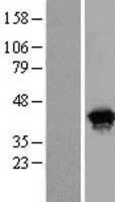 Western Blot: HSPC142 Overexpression Lysate (Adult Normal) [NBL1-08283] Left-Empty vector transfected control cell lysate (HEK293 cell lysate); Right -Over-expression Lysate for HSPC142.