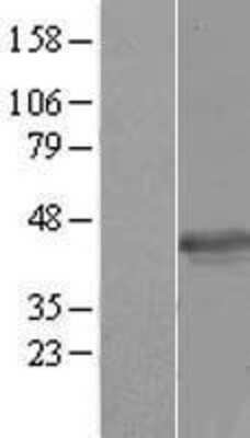 Western Blot: HSPC142 Overexpression Lysate (Adult Normal) [NBP2-10335] Left-Empty vector transfected control cell lysate (HEK293 cell lysate); Right -Over-expression Lysate for HSPC142.