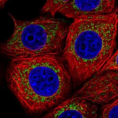 Immunocytochemistry/Immunofluorescence: HSPC268 Antibody [NBP2-31902] - Staining of human cell line MCF7 shows localization to mitochondria. Antibody stainign is shown in green.