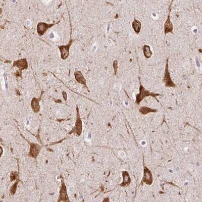Immunohistochemistry: HSPC268 Antibody [NBP2-32036] - Staining of human hippocampus shows strong cytoplasmic positivity in neuronal cells.