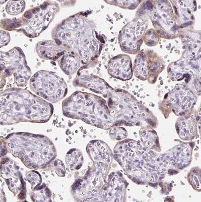 Immunohistochemistry-Paraffin: HSPC268 Antibody [NBP2-31902] - Staining of human placenta shows weak granular cytoplasmic positivity in trophoblastic cells.
