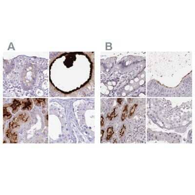 Immunohistochemistry-Paraffin: HSPC323 Antibody [NBP1-93687] - Staining of human colon, epididymis, kidney and testis using Anti-SMIM24 antibody NBP1-93687 (A) shows similar protein distribution across tissues to independent antibody NBP2-58735 (B).