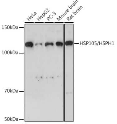 Western Blot: HSPH1/HSP105 Antibody (9Y7M10) [NBP3-16463] - Western blot analysis of extracts of various cell lines, using HSPH1/HSP105 Rabbit mAb (NBP3-16463) at 1:1000 dilution. Secondary antibody: HRP Goat Anti-Rabbit IgG (H+L) at 1:10000 dilution. Lysates/proteins: 25ug per lane. Blocking buffer: 3% nonfat dry milk in TBST. Detection: ECL Basic Kit. Exposure time: 90s.