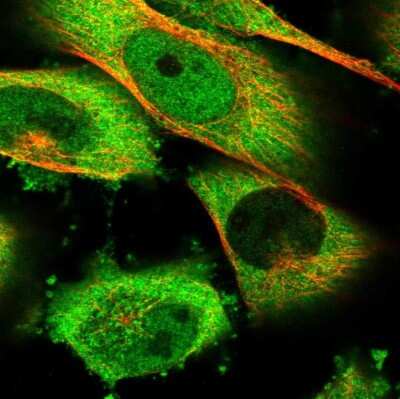 Immunocytochemistry/Immunofluorescence: HSPH1/HSP105 Antibody [NBP1-89662] - Staining of human cell line U-251 MG shows localization to nucleoplasm & cytosol. Antibody staining is shown in green.