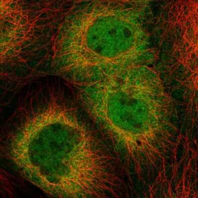 <b>Independent Antibodies Validation. </b>Immunocytochemistry/Immunofluorescence: HSPH1/HSP105 Antibody [NBP2-55047] - Staining of human cell line A-431 shows localization to nucleoplasm & cytosol.