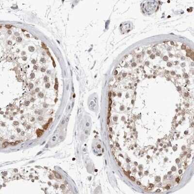 Immunohistochemistry-Paraffin: HSPH1/HSP105 Antibody [NBP1-89662] - Staining of human testis shows strong cytoplasmic positivity in basal cells in seminiferus ducts.