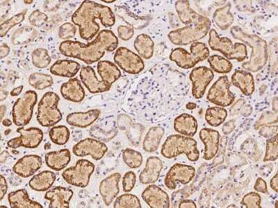 Immunohistochemistry-Paraffin: HSPH1/HSP105 Antibody [NBP2-97291] - Immunochemical staining of human HSPH1/HSP105 in human kidney with rabbit polyclonal antibody at 1:100 dilution, formalin-fixed paraffin embedded sections.