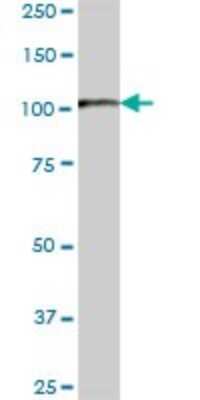Western Blot: HSPH1/HSP105 Antibody [H00010808-B01P] - Analysis of HSPH1 expression in human liver.