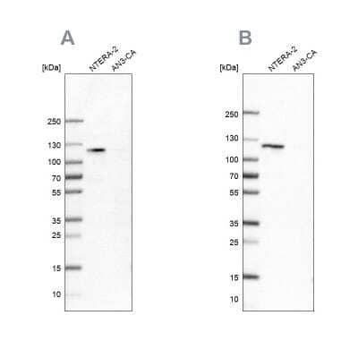 Western Blot: HSPH1/HSP105 Antibody [NBP2-55047] - Analysis using Anti-HSPH1 antibody NBP2-55047 (A) shows similar pattern to independent antibody NBP1-89662 (B).