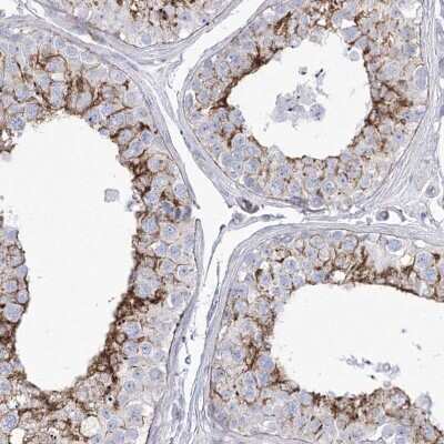 Immunohistochemistry-Paraffin: HSU79274 Antibody [NBP2-47425] - Staining of human testis shows high expression.