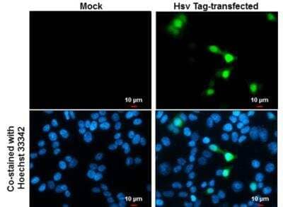 Immunocytochemistry/Immunofluorescence: HSV Tag Antibody (223) [NBP2-43816] - Mock and transfected 293T cells were fixed in 4% paraformaldehyde at RT for 15 min. Green: Hsv Tag stained by Hsv Tag antibody [223]  diluted at 1:2000.Blue: Hoechst 33342 staining. Scale bar= 10um. 