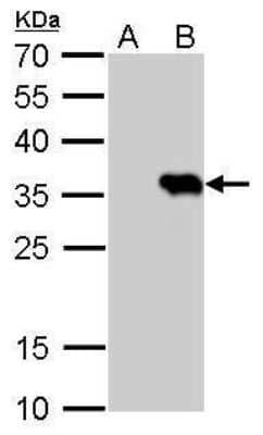 Western Blot HSV Tag Antibody (223)