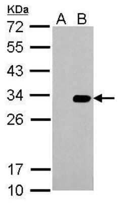 Western Blot: HSV Tag Antibody [NBP2-43815] - Analysis of A. 5 ug 293T whole cell lysate/extract B. 5 ug whole cell lysate/extract of HSV-tagged protein expressing 293T cells 12 % SDS-PAGE Hsv Tag antibody dilution: 1:10000.